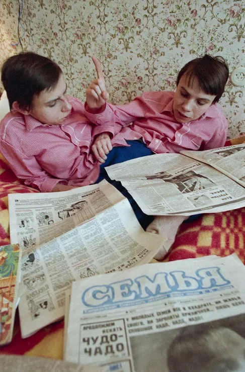 Страшная судьба: история первых сиамских близнецов в СССР