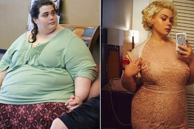 5 самых невероятных преображений участников шоу «Я вешу 300 кг»: фото до и после