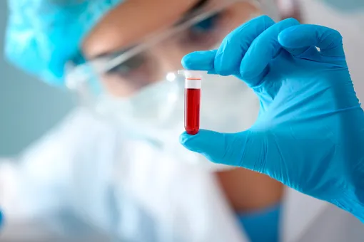 Японские ученые разработали анализ крови для выявления рака