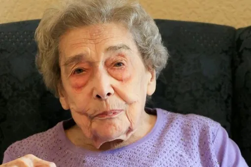 Секрет долголетия 106-летней британки: никакого секса и стрессов
