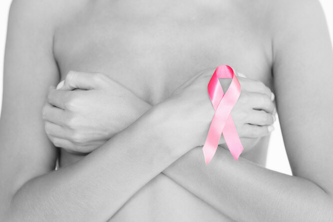 Рак груди: проверьте свои факторы риска
