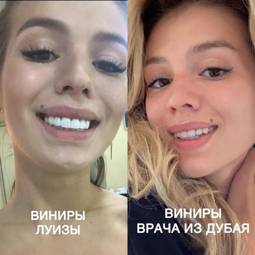 Люся Чеботина привела доказательство недобросовестной работы звёздного стоматолога