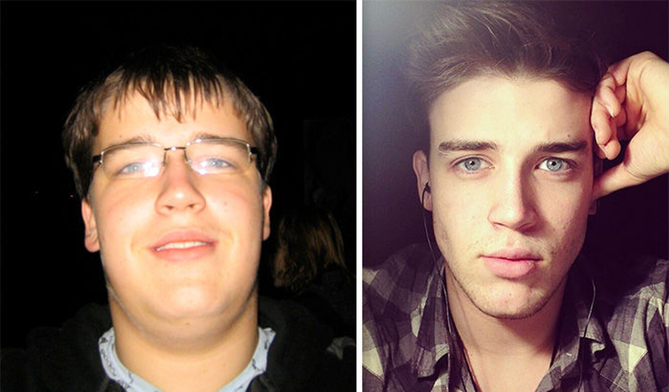 Почему у подростков щеки. Лицо до и после похудения. Парни до и после похудения. Лицо до и после похудения у парней. Трансформация мужского лица.