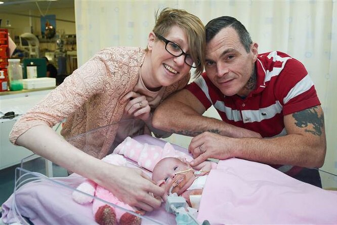 Одномесячная малышка, родившаяся с сердцем наружу, выиграла первую схватку за жизнь