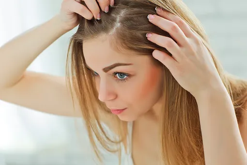 Выпадение волос: 5 причин, о которых вы не догадывались