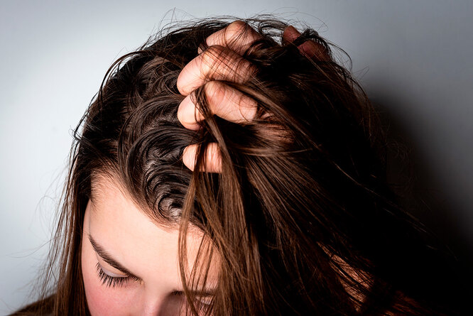 Почему волосы так быстро становятся жирными: не всегда дело в болезнях
