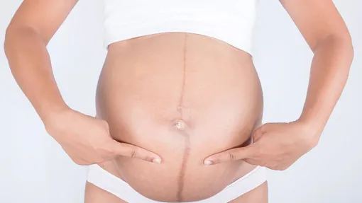 темная линия на животе беременной