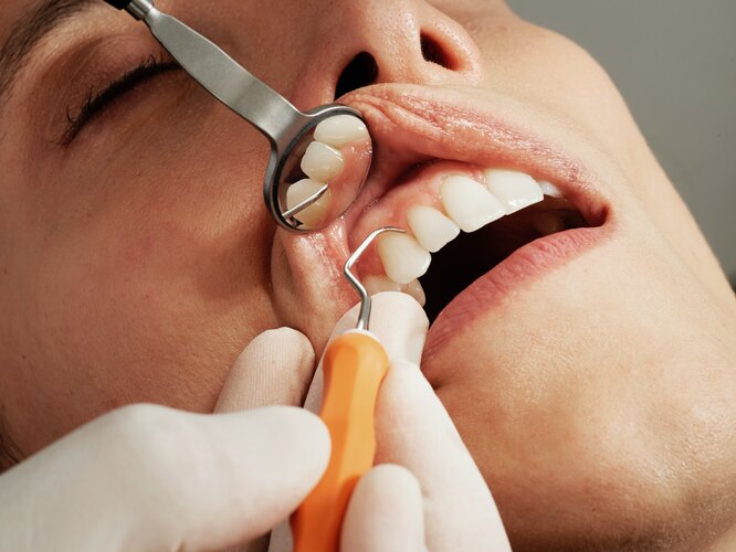 стоматолог осматривает зубы