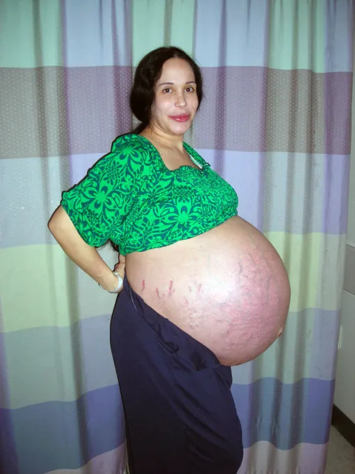 многоплодная беременность фото