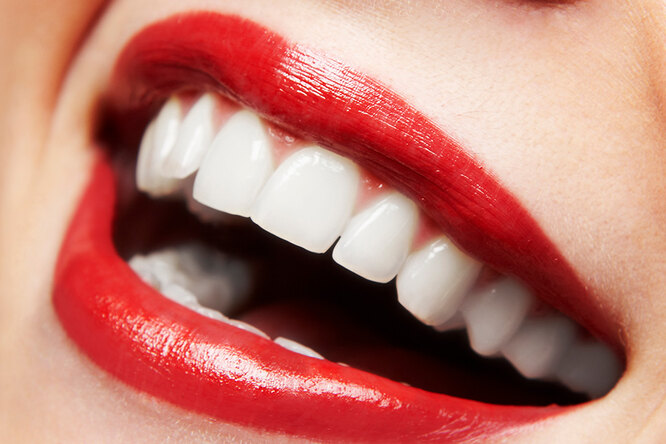 Отбеливание зубов дома: 5 способов, которые работают