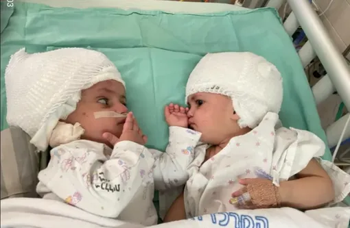 близняшки в больнице