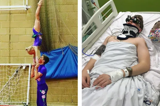 Врачи разводят руками: юный гимнаст, сломавший шею при неудачном прыжке, через 4 дня встал на ноги