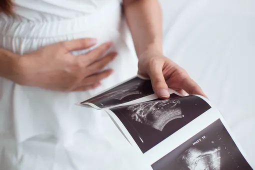 Беременность рассосалась: что такое анэмбриония и как с ней быть?