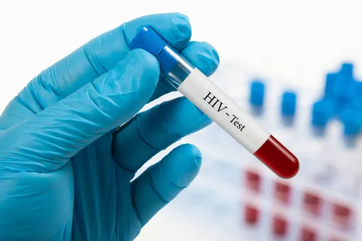 Пятый человек в мире полностью излечился от ВИЧ