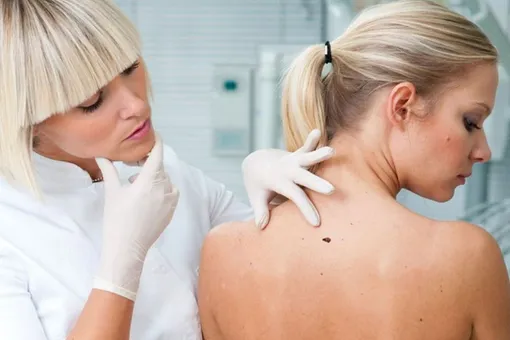 6 важных фактов о раке кожи, которые могут спасти жизнь