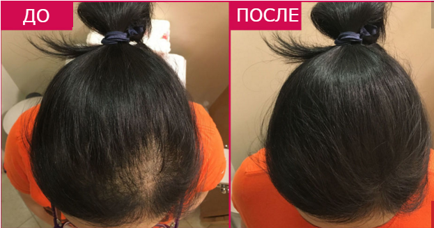 Как стать красивой быстро и просто: 12 полезных советов красоты Как стать красивой быстро и просто: 12 полезных советов красоты