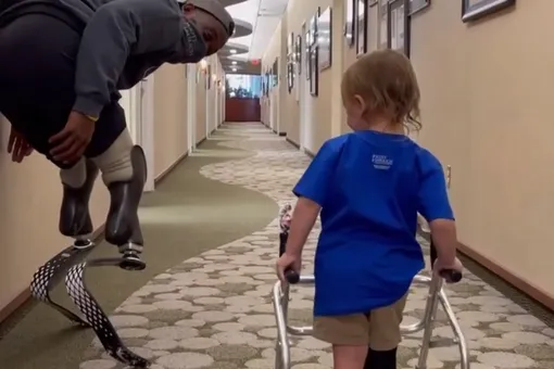 Паралимпийский чемпион трогательно поддержал 2-летнюю девочку, потерявшую ногу