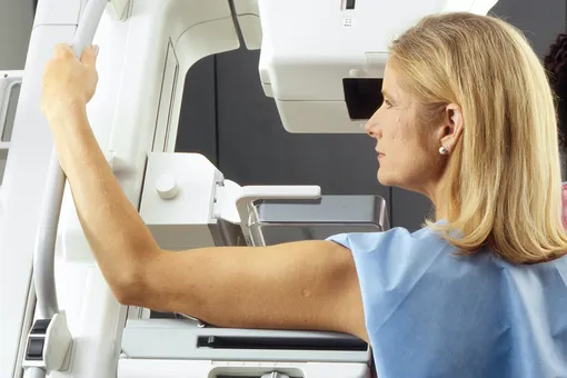 Как расшифровать результаты маммографии: категории BI-RADS и их значения