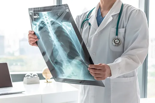 Хроническая обструктивная болезнь лёгких: 8 симптомов, что вы больны