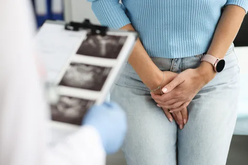 Это не работает: лазерная терапия вагины для женщин в менопаузе