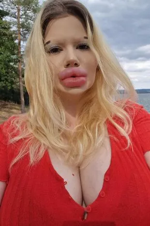 Женщина с самыми большими губами в мире