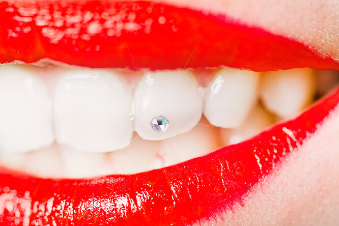 Улыбка с ошибкой: 5 вещей, которые нельзя делать со своими зубами у стоматолога