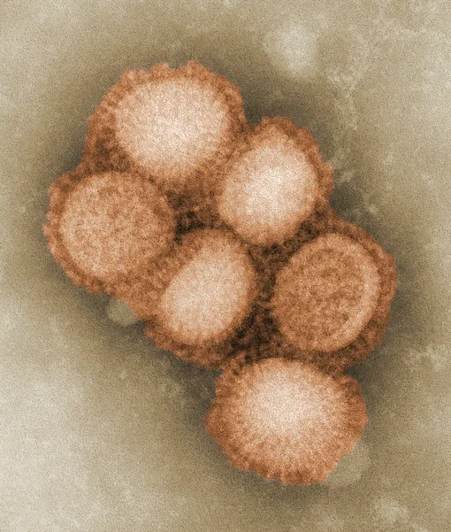 Так выглядит вирус свиного гриппа