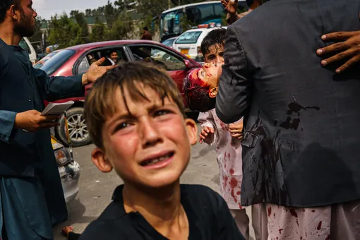 Мужчина несет окровавленного ребенка, а женщина кладет раненую на улицу после того, как боевики Талибана используют огнестрельное оружие, кнуты, палки и острые предметы, чтобы удержать контроль над тысячами афганцев, которые продолжают ждать у кабульского аэропорта выхода. Дорога к аэропорту в Кабуле, Афганистан, вторник, 17 августа 2021 г. Не менее полдюжины были ранены в течение часа эскалации насилия, в том числе женщина и ее ребенок