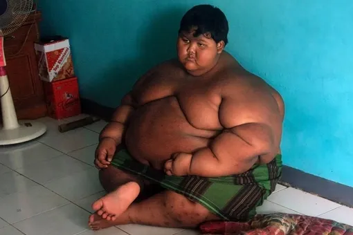 13-летний мальчик за три года похудел на 110 кг