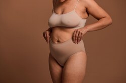 Какие процедуры действительно убирают растяжки на теле?