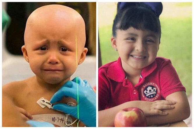 Они победили рак! 10 невероятных фотографий людей до и после болезни