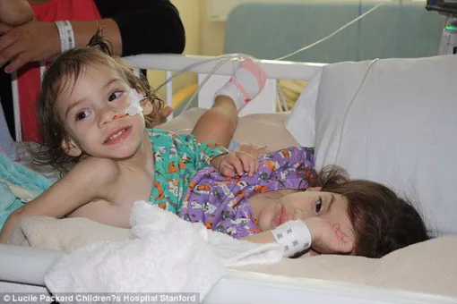 Разделенных сиамских близнецов выписали из больницы. Хроника чуда