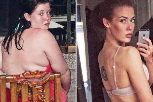 Как чайная ложка помогла этой девушке похудеть на 65 кг