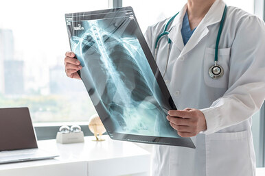 6 признаков того, что это может быть рак лёгких