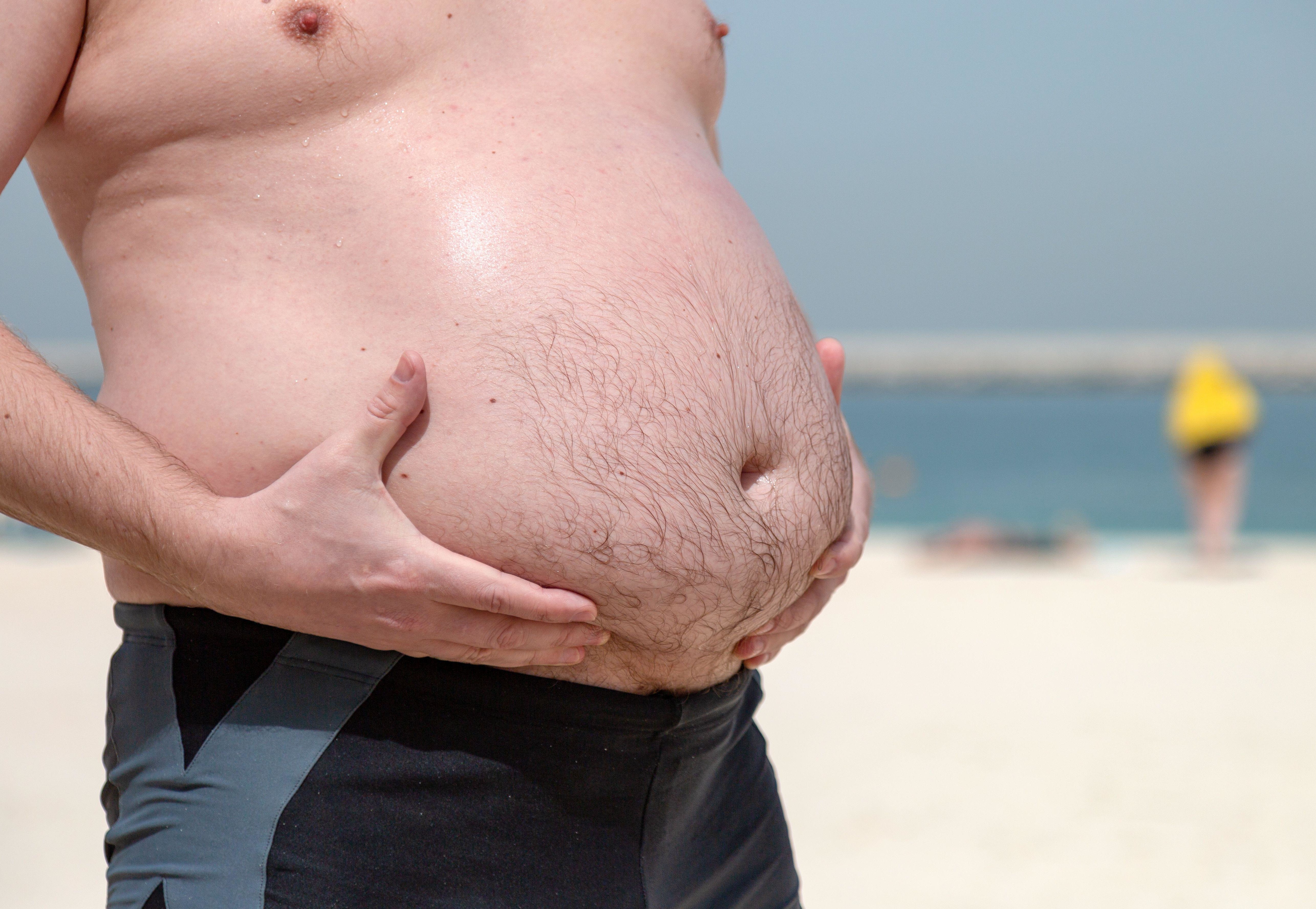 Почему у мужчин растёт живот: причины ожирения по мужскому типу