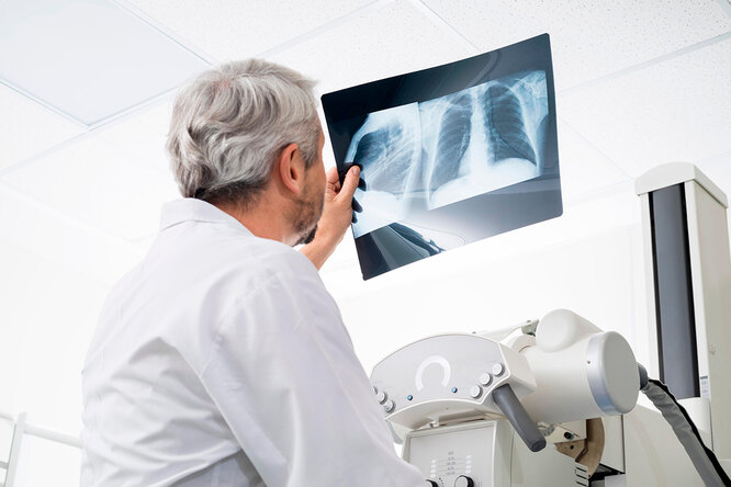 Как проверить легкие: рентген или компьютерная томография?