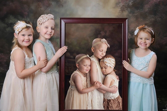 «Мы победили!» Невероятные фотографии девочек, сделанные во время лечения от рака и после него
