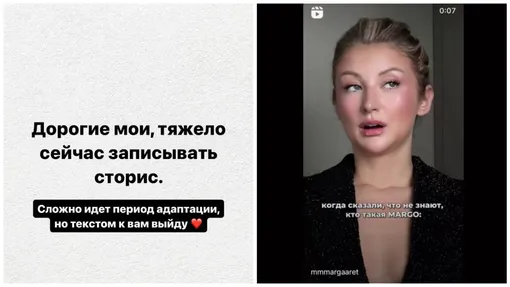 Марго овсянникова до и после пластики