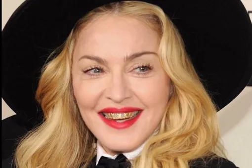 Улыбка Мадонны: новый старый тренд
