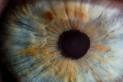 Рак глаз редкое заболевание, которое встречается у детей до 5 лет и пожилых в возрасте 75+
