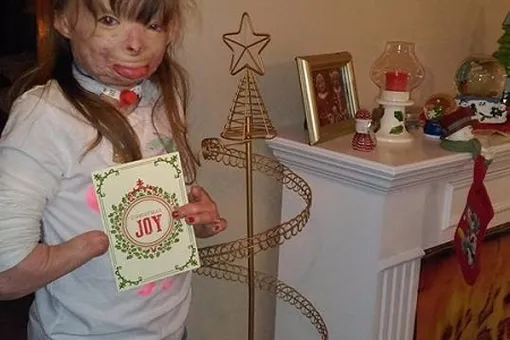 Девочка, потерявшая семью в пожаре, ждет рождественских открыток