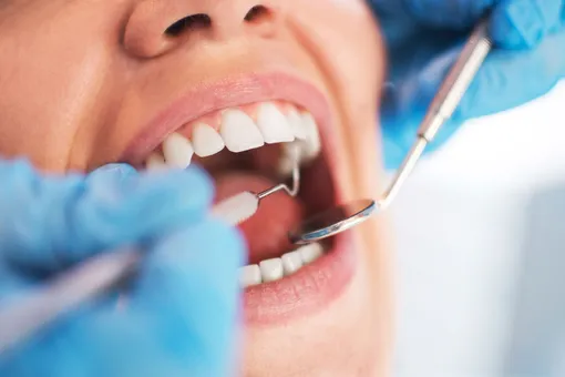 В США стоматолог заработал миллионы, намеренно портя пациентам здоровые зубы