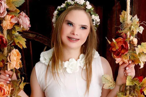 14-летняя девочка с синдромом Дауна стала успешной моделью