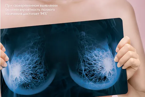 Ранняя диагностика рака груди спасает жизни