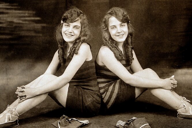Приходите на нас посмотреть: грустная история сиамских близнецов — Дейзи и Вайолет Хилтон
