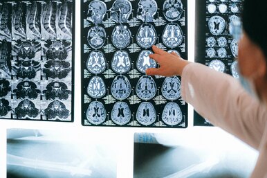 Опухоли головного мозга: симптомы, диагностика, прогнозы и реабилитация