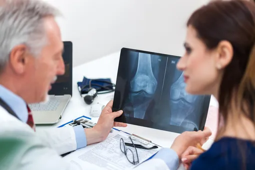 Как не допустить остеопороза? 3 главных правила профилактики
