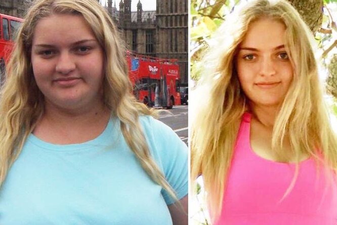«Я была слишком ленива, чтобы меняться»: 19-летняя австралийка похудела на 63 кг за год