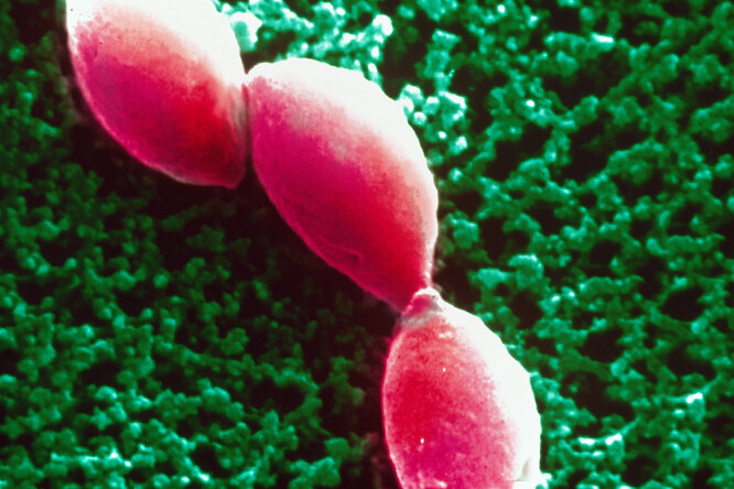 Так выглядит тот самый паразит — Toxoplasma gondii Так выглядит тот самый паразит — Toxoplasma gondii