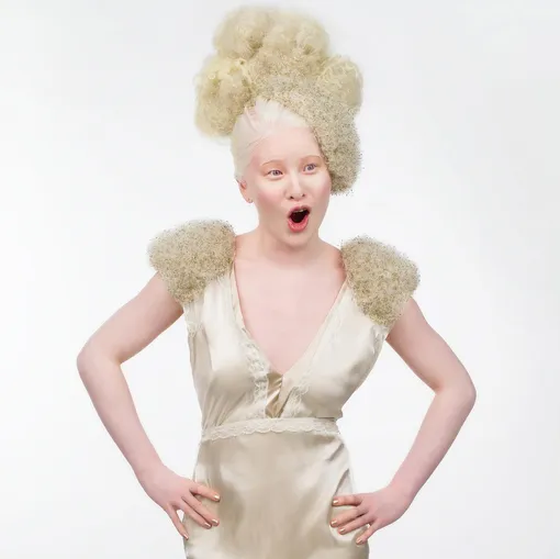 модель альбинос